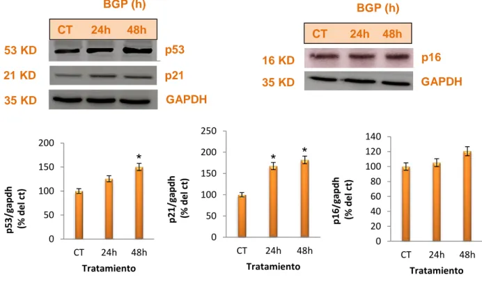 Figura  1.  El  tratamiento  con  β-glicerofosfato  induce  senescencia  vía  p53  y  p16 INK4a 