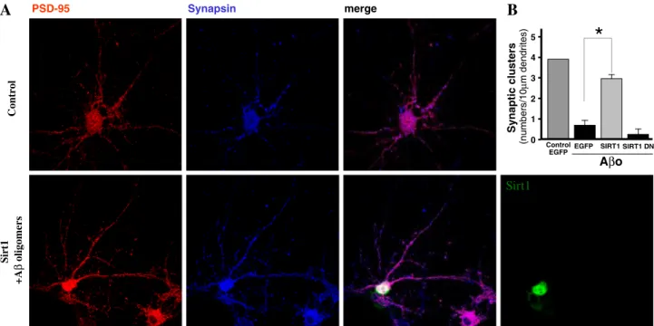 Fig. 4 Sirt1 protects rat hippocampal neurons against A β challenge.