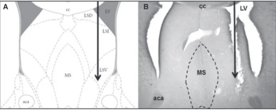 Fig. 1. (A) Lateral septum (LS) scheme extracted from the rat brain atlas (Paxinos and Watson) [22]