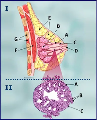 Figura 1: Carcinoma ductal infiltrante  I: Sección sagital de la mama 