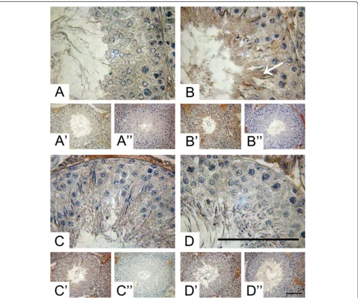 Figure 2 Stage-specific immunolocalisation of ADAM10 in adult rat testes. (A) High and low (A ’) power magnification of Pale (stage IX-XII), Weak (stage XIII-I) (B, B ’), Strong (stage II-V) (C, C’) and Dark (VI-VIII) (D, D’) stages