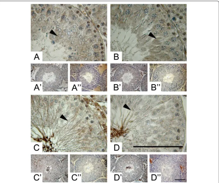 Figure 3 Stage-specific immunolocalisation of ADAM17 in adult rat testes. (A) High and low (A ’) power magnification of Pale (stage IX-XII), Weak (stage XIII-I) (B, B ’), Strong (stage II-V) (C, C’) and Dark (VI-VIII) (D, D’) segments