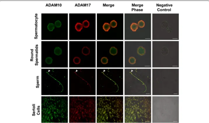 Figure 4 Colocalization of ADAM10 and ADAM17 in isolated germ and Sertoli cells. Isolated germ and Sertoli cells were double labelled with anti-ADAM10 (green) and anti-ADAM17 (red)