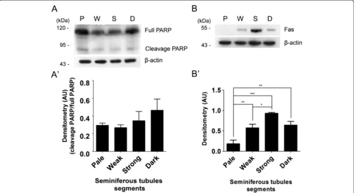 Figure 7 Stage-specific upregulation of FAS levels. (A, A ’) Poly-(ADP-Ribose) polymerase (PARP) and (B, B’) FAS levels in Pale (P, stage IX-XII), Weak (W, stage XIII-I), Strong (S, stage II-V) and Dark (D, VI-VII) segments