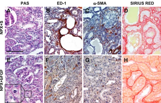 Fig. 1. Morphological damage in kidneys from rats after 5 ⁄ 6 nephrectomy (NPX).  Immunohis-tochemistry was performed in kidney samples collected 35 days after NPX (n ⫽ 7/NPX group) injected with saline (S; A–D) or with basic fibroblast growth factor (bFGF