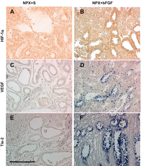 Fig. 3. Immunolocalization of endothelial cell markers in kidneys from NPX rats. Staining intensity for HIF-1 ␣ (A and B), VEGF (C and D), and Tie-2 (E and F) were observed in the remaining kidneys 35 days after NPX and injection with bFGF (B, D, and F) or