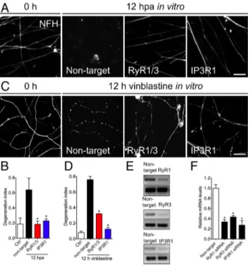 Figure 3. Genetic knockdown of RyaR and IP 3 R1 protects degeneration of mechanically or toxic injured axons