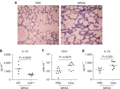 Figure 6 Interleukin-16 (IL-16) is produced by CD4 þ cells. (a) Immunohistochemistry by standard methods with anti-IL-16 antibody on fixed-whole lungs of C57BL/6J WT given phosphate-buffered saline (PBS) or infected with 10 7 colony-forming units methicill