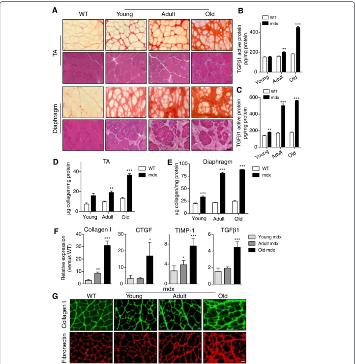 Figure 2 Quantification of fibrosis in muscle of mdx mice. (A) Sirius red and H&amp;E staining of mdx tibialis anterior (TA) (upper panels) and diaphragm (lower panels) muscles at different ages compared to adult wild-type (WT) muscle