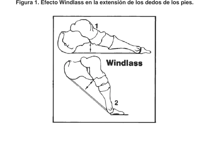 Figura 1. Efecto Windlass en la extensión de los dedos de los pies. 