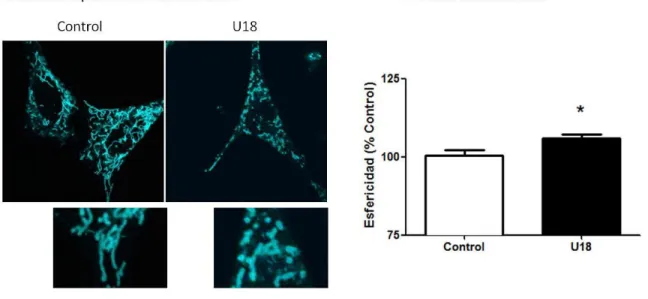 Figura  6:  Los  fibroblastos  de  embrión  de  ratón  tratados  con  U18  presentan  alteraciones  en  la  morfología mitocondrial