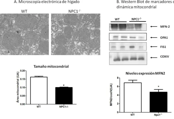 Figura 8: Las mitocondrias de hígado de ratones Npc1 -/-  son más pequeñas y presentan disminución  de MFN2   