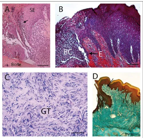 Figure 1.  Cellular and histologic events involved in gingival wound healing. (A) Tissue  section shows the inflammatory phase of gingival wound healing