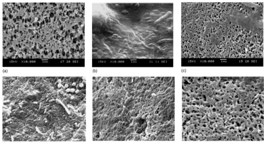 Figura 7: Imágenes SEM de una membrana de microfiltración sin usar (a),  la misma sucia (b) y  tras la  limpieza a través de:  c) sonicación, d) agentes químicos, e) retrolavado con agua deionizada, f) 