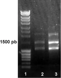 Figura 3.  Electroforesis en gel de agarosa al 1 % y tinción con bromuro de etidio del  producto de la reacción de PCR empleando los oligonucleótidos ICL D e ICL R