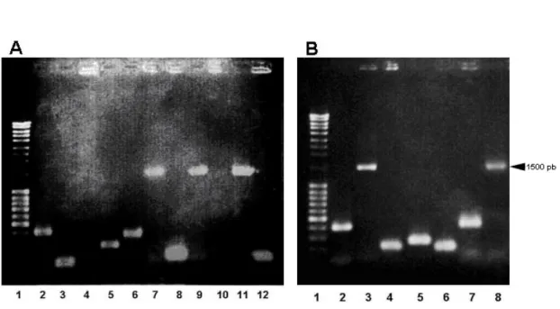 Figura 4. Electroforesis en gel de agarosa al 1 % y tinción con bromuro de etidio de digestión  con   BglIl del ADN de los clones aislados.