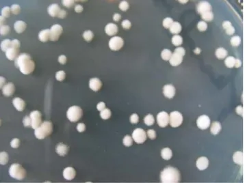 Figura 8. Colonias de M. fijiensis crecidas en medio sólido con glicerol a los 14 días de  incubación, a 28 °C y oscuridad constante