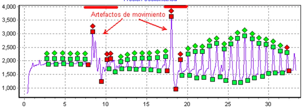 Figura 2.23. Diferencias entre los artefactos de movimiento y los pulsos  normales. 