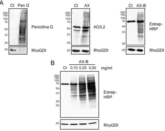 Figura 1: Modificación de proteínas por antibióticos betalactámicos en linfocitos B.  Los linfocitos B RPMI 8866 se trataron durante 16 horas con penicilina G 10 mg/ml, con  amoxicilina  2,5  mg/ml,  o  con  AX-B  0,5  mg/ml  (A)  o  a  las  concentracione