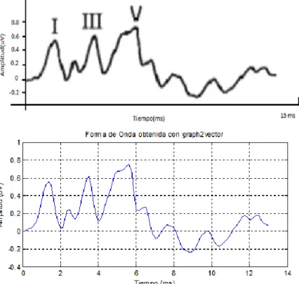 Figura 3. 1. Señal obtenida con graph2vector 