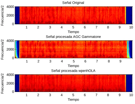 Figura  3.10.  Espectrogramas  de  la  señal  original,  procesada  por  Gammatone  y  procesada  por Wavelet Packets