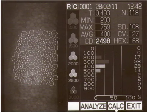 Fig 7: Imagen de una biomicroscopia especular en la que se observa las células endoteliales así  como los distintos índices de medida que se obtienen