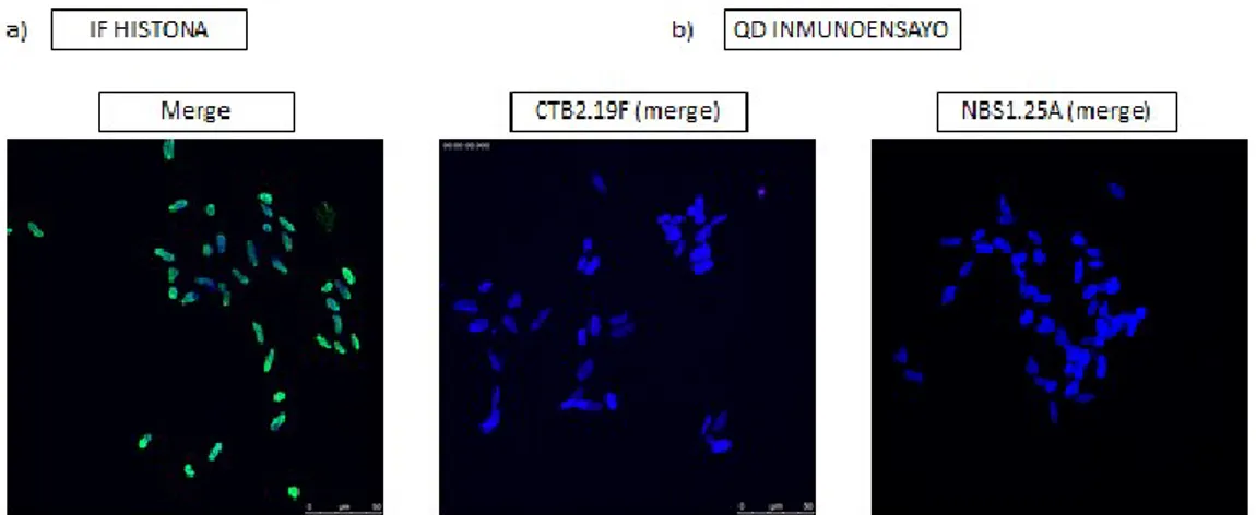 Figura 5.- Marcaje específico de histona en la línea celular SH-SY5Y. a) inmunofluorescencia clásica  en dos pasos