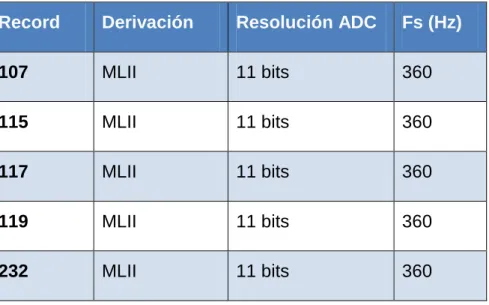 Tabla 1: Compresión de señales ECG para un PRD 2 % 