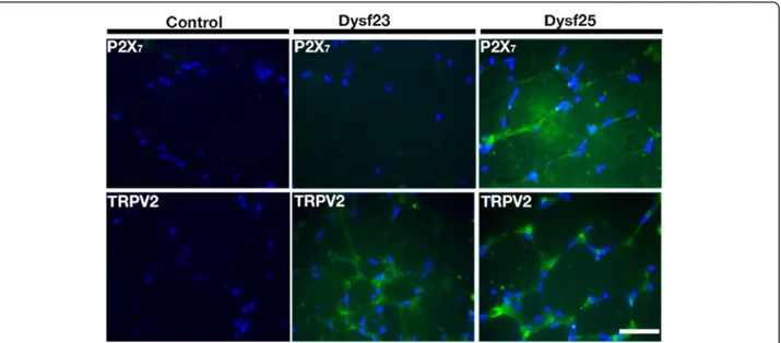 Fig. 3 Presence of P2X 7 receptor and TRPV2 channel in muscular biopsies from dysferlinopathy patients