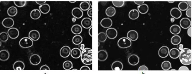 Fig. 1.11: a) Imagen gradiente y b) Cierre por área de la imagen gradiente. 