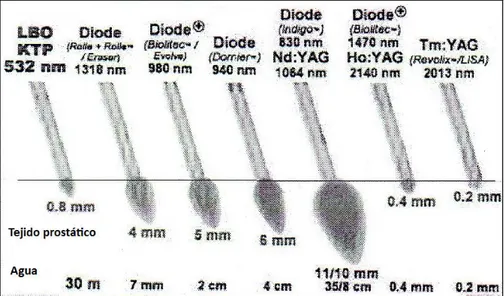 Figura 11: Penetración de los distintos láseres en próstata y agua 