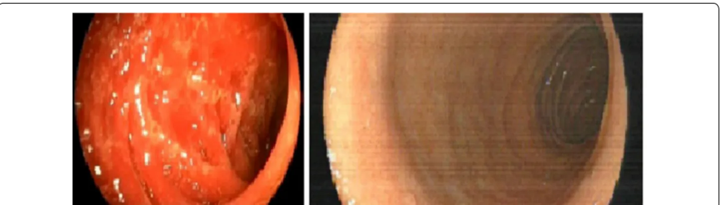 Fig. 3  a Erythroderma at diagnosis of aGVHD. b Regression of cutaneous aGVHD after 2 weeks of treatment with ruxolitinib