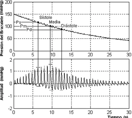 Figura 1.2. Señal de rampa de presión en el manguito y señal oscilométrica 