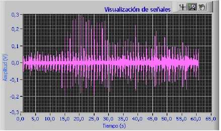 Figura 3.2.  Señal auscultatoria. 