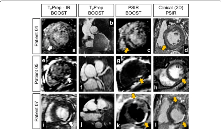 Fig. 5 Comparison between the proposed 3D whole-heart BOOST framework and the clinical 2D PSIR acquisition