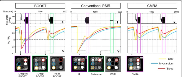Fig. 2 Sequence simulations and phantom images comparing BOOST and conventional sequences for LGE assessment and CMRA