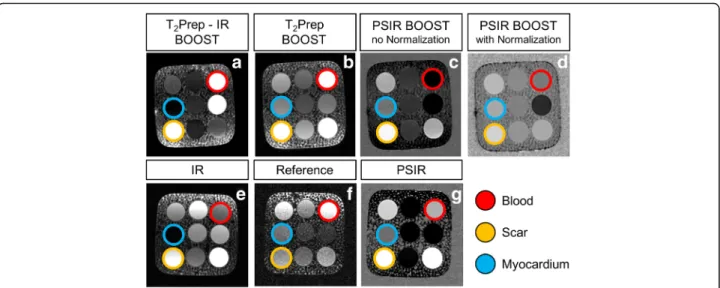 Fig. 3 Phantom images obtained with the BOOST and the conventional PSIR sequence. Imaging data were acquired by nulling the signal from the healthy viable myocardium (blue vial) in the magnitude images (a, e)