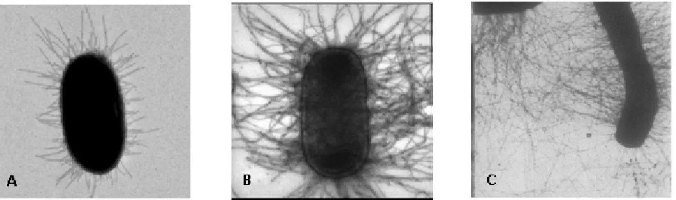 Figura  4. Ejemplos  de  diferentes  fimbrias  de Escherichia  coli observadas  al microscopio  electrónico