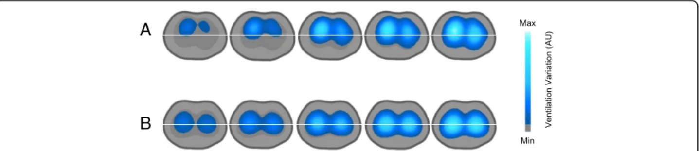 Figure 5 exemplifies a functional image divided into two ROIs (ventral and dorsal) in a porcine model of ARDS.
