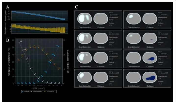 Fig. 6 Estimation of recruitable lung collapse and overdistension during decremental positive end-expiratory pressure (PEEP) maneuver