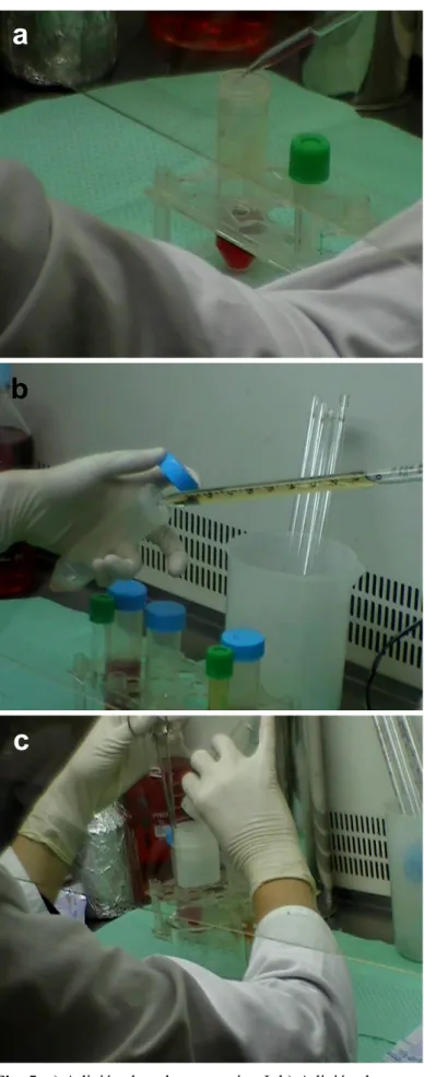 Fig. 5. a) Adición de colagenasa tipo I, b) Adición de  tripsina, c) Filtrado de la suspensión celular a través de una  maya de 100 µm