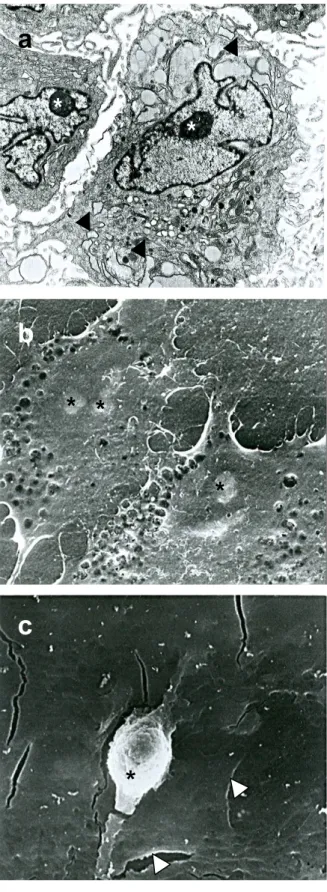 Fig. 8. Imágenes de microscopia electrónica. a) MDSC con un retículo altamente secretor (▲)  (MET  4000x)