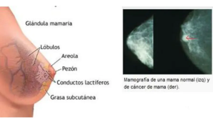 Figura 1. Representación de una mama y mamografía 
