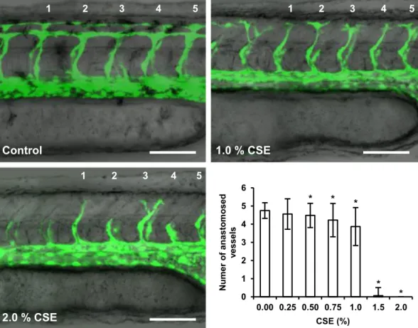 Figure 3.  Effect of cigarette smoke on zebrafish vascular development. An impairment of intersegmental  vessel (ISVs) formation and extension in one-day old transgenic Tg(fli1a:EGFP) y1  embryos was observed upon  exposure to increasing CSE-concentrations