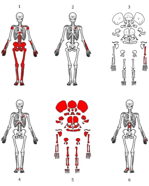 Figura 9. Detalle de los elementos esqueletales presentes (en rojo) de cada individuo en la Estructura 1: (1) entierro intrusivo sobre  el piso ocupacional; (2) restos esqueletales en la fosa 1; (3) individuo perinatal de la fosa 2; (4) individuo adulto de
