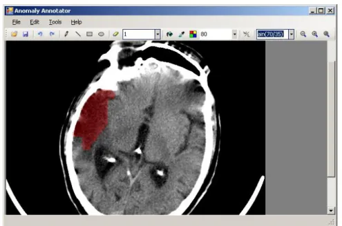 Figura 2.1. Anomaly Annotator: Software para la anotación de anomalías en imágenes  médicas