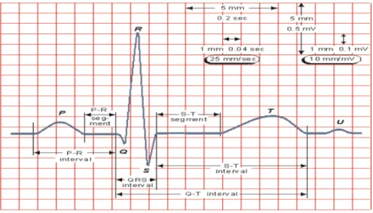 Figura 2. Representación de la señal ECG ideal.  