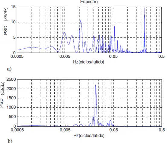 Figura 4. Respuesta de frecuencias de la señal RR para un paciente de la base de datos de Physionet