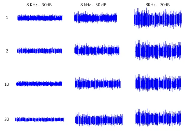 Figura  3.1. Representación  gráfica   de los  segmentos  de los  registros  de PEAEE  3.2  Detección de los potenciales evocados auditivos  de estado estable 