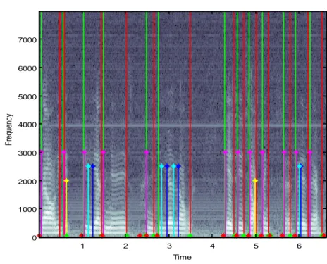 Figura II.16   Espectrogra ma de la  Oración 2 del Pac iente AT3F 